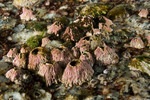 Thoracicalcarea