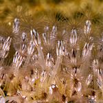 Thoracicalcarea